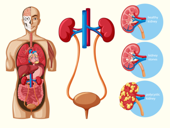 মানবদেহে কিডনি প্রতিস্থাপন